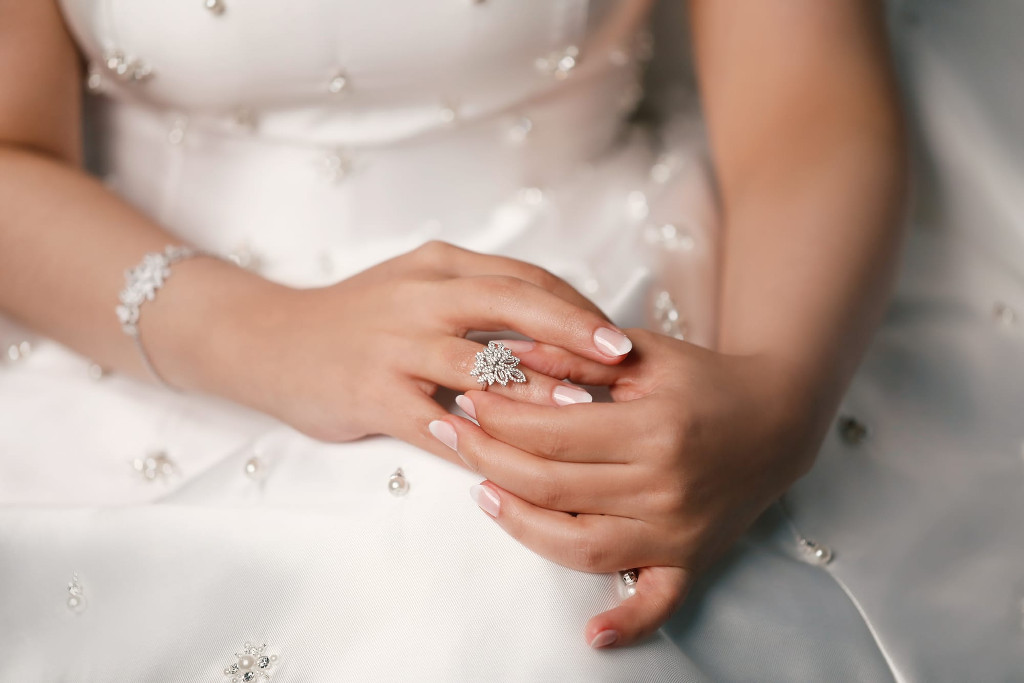 تصويرالآعراس