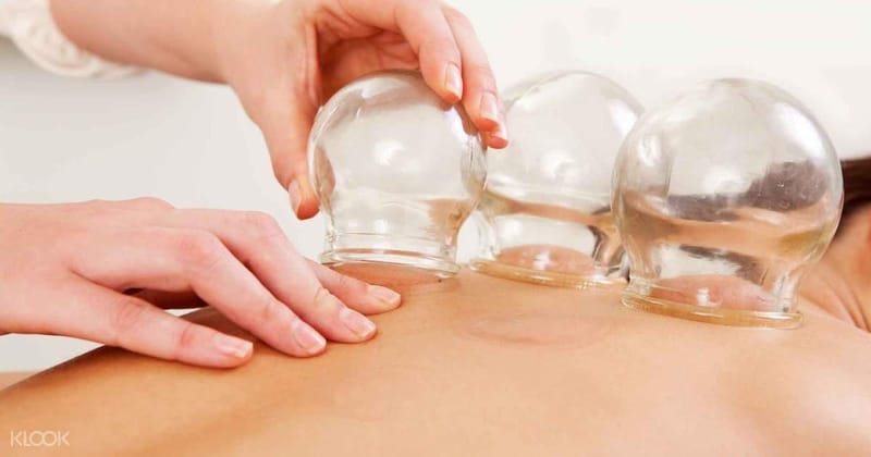 Cupping