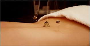 Moxibustion