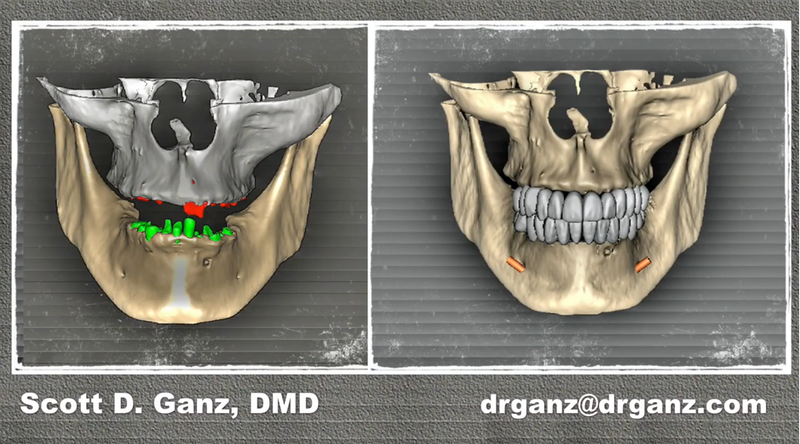 AIE Live Surgery Lecture #2