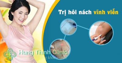 Các biện pháp Chữa bệnh hôi nách khỏi hoàn toàn tại nhà