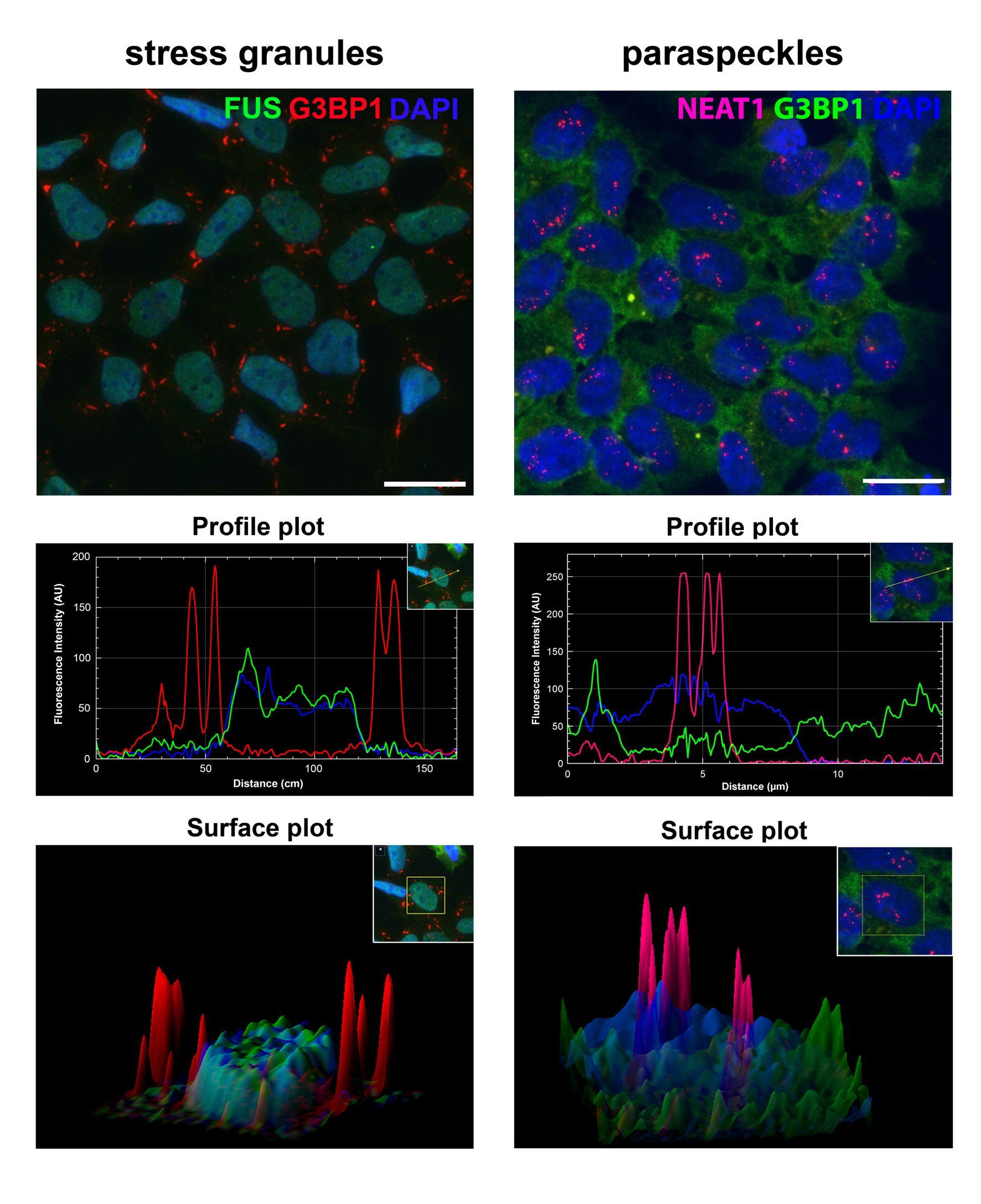 Regulation of stress granules and paraspeckles under stress and in disease states