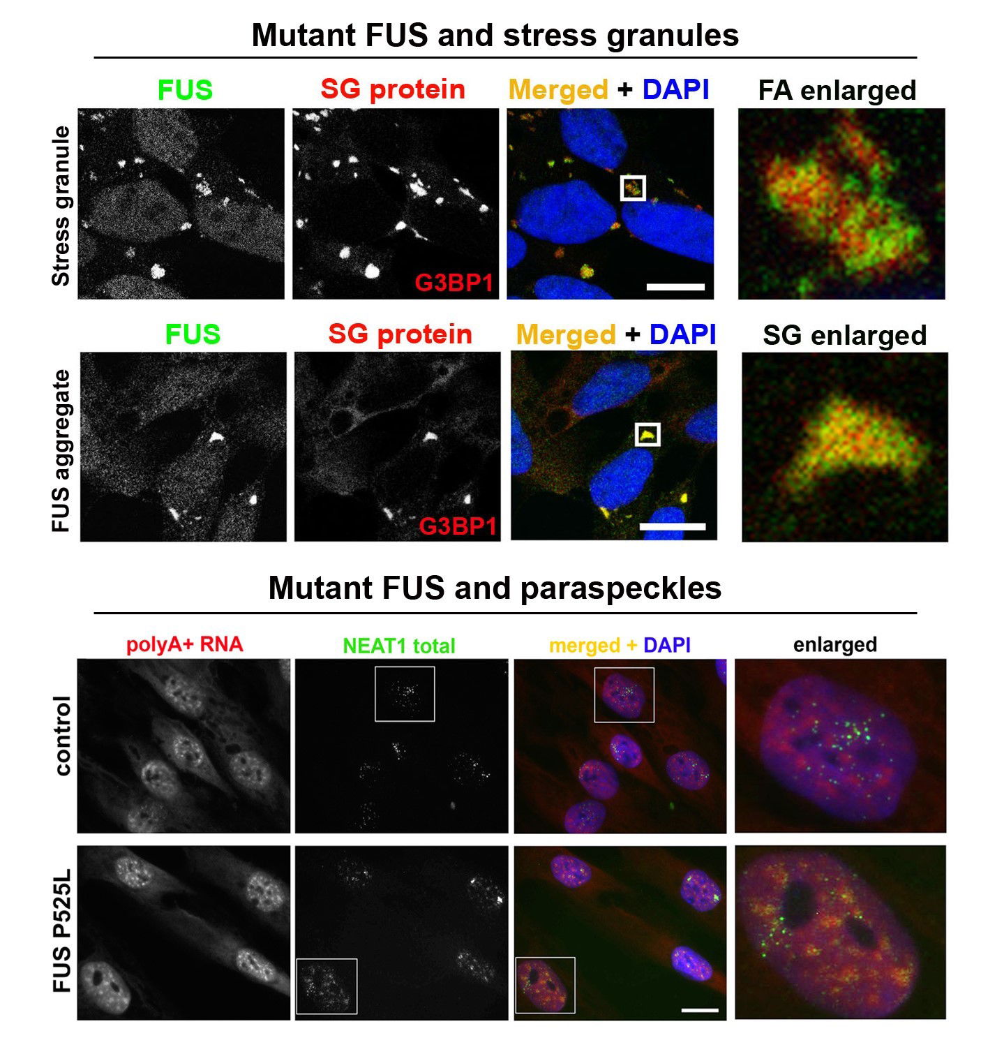 Molecular mechanisms of amyotrophic lateral sclerosis (ALS) and related neurodegenerative disorders