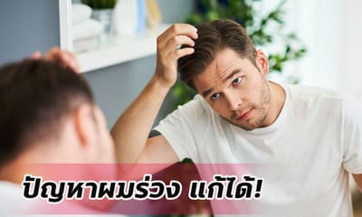 ผมขาดหลุดร่วง 5 อาหารหาง่ายที่ช่วยให้ผม คุณแข็งแรงสำหรับคุณผู้ชาย