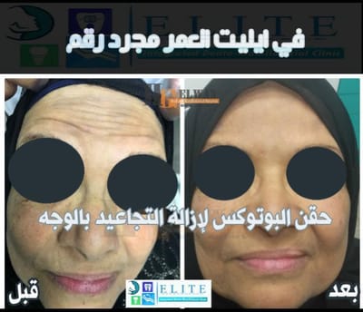 عن مركز ايليت  image
