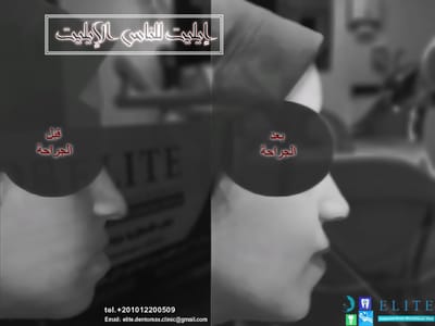عن مركز ايليت  image