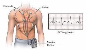 HOLTER CARDIACO image