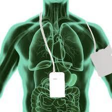 HOLTER PRESSORIO image