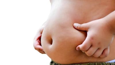 Factores que favorecen el sobrepeso y la obesidad