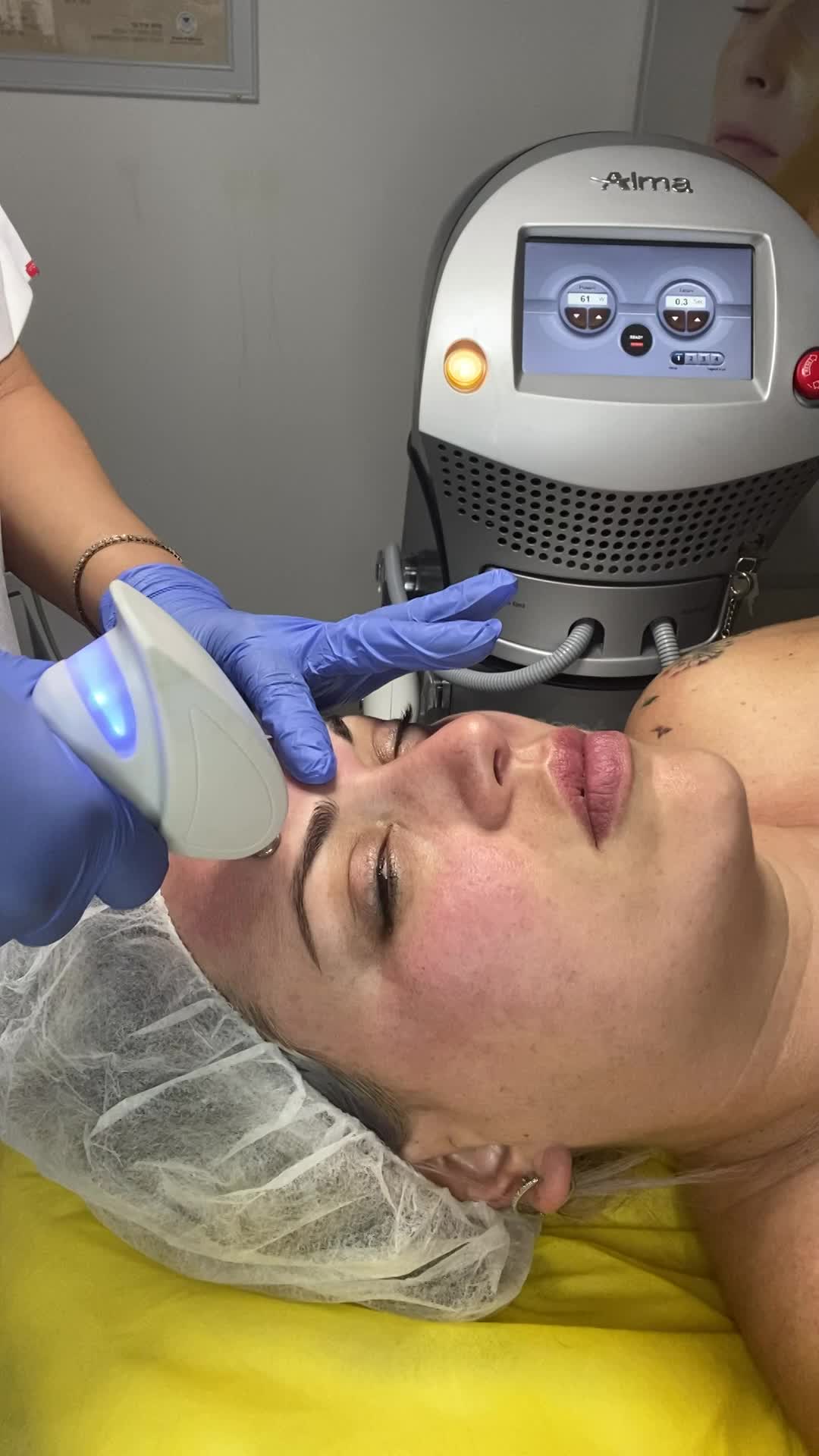 טיפול במכשיר האקסנט ידית הפלאזמה