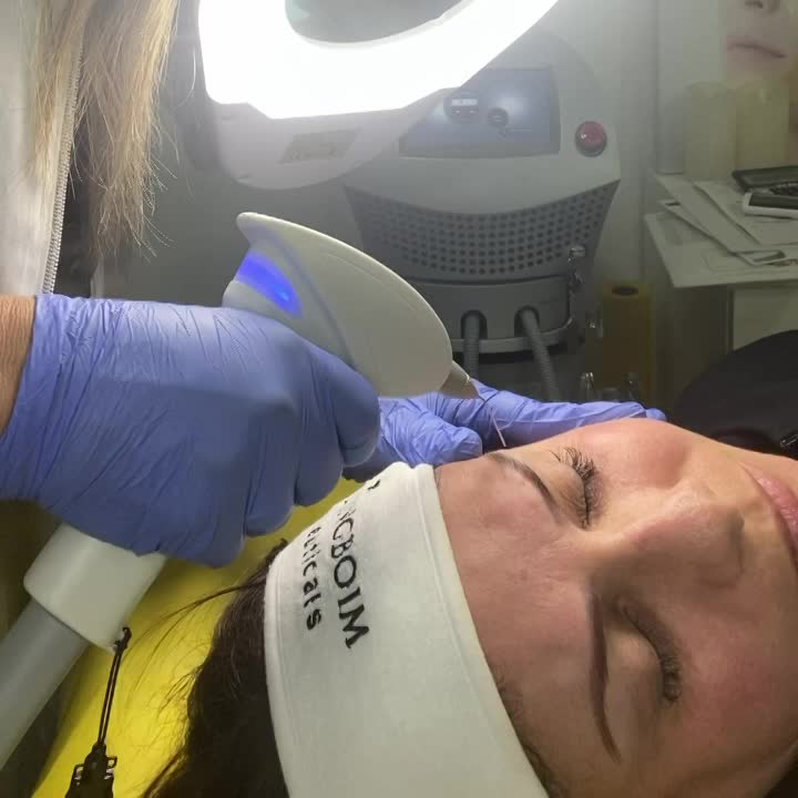 מכשיר האקסנט פרו טיפול בקמטים