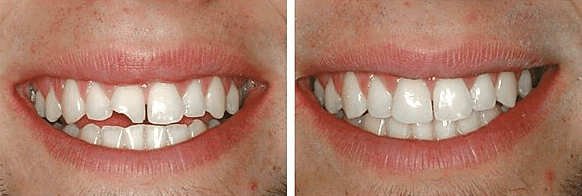Restoratives & Cosmetics