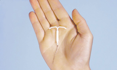 Intrauterine Device (IUD)