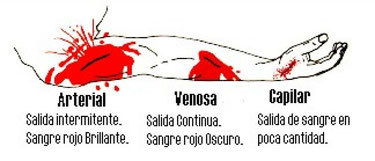 Clasificación de Hemorragias según el tipo de vaso sanguíneo