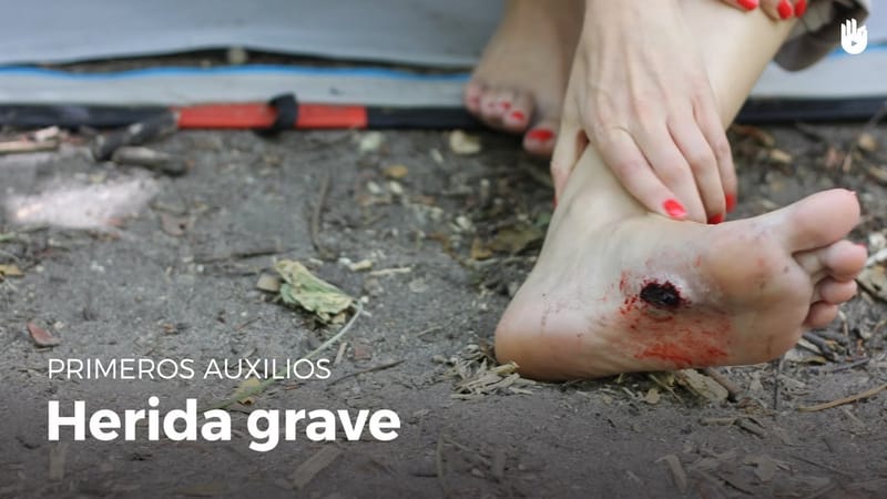 Video Instructivo de Primeros Auxilios para Heridas Graves o Complicadas