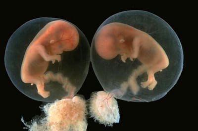 الطفلان والحبل السرّي