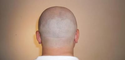 وكَانَ قَدْ حَلَقَ رَأْسَهُ في قَنْخَرِيَّة، لِنَذْرٍ كَانَ عَلَيْه