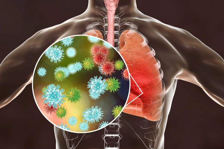 الأنفلونزا والكورونا (إقرأ المقال وانشره ليستفيد الجميع)