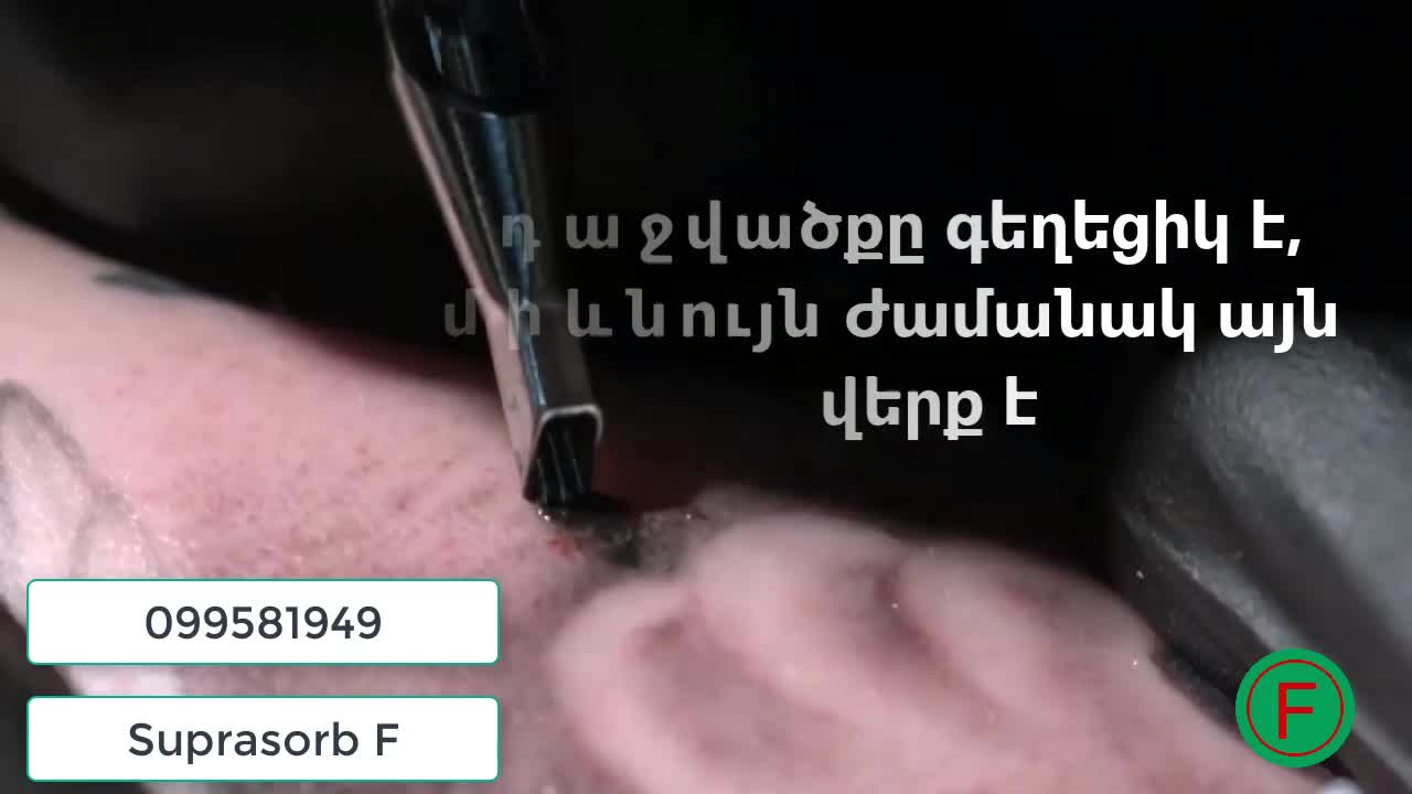 դաջվածքը խնամել է պետք