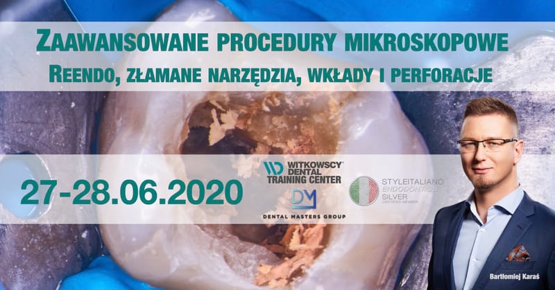 Zaawansowane procedury endodontyczne
