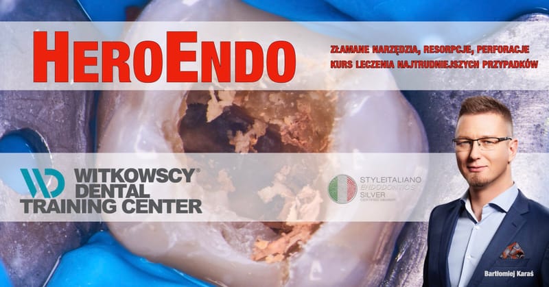 HeroEndo - złamane narzędzia, resorpcje, perforacje - kurs leczenia najtrudniejszych przypadków.