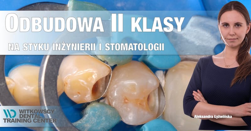Odbudowa klasy II - Na styku inżynierii i stomatologii