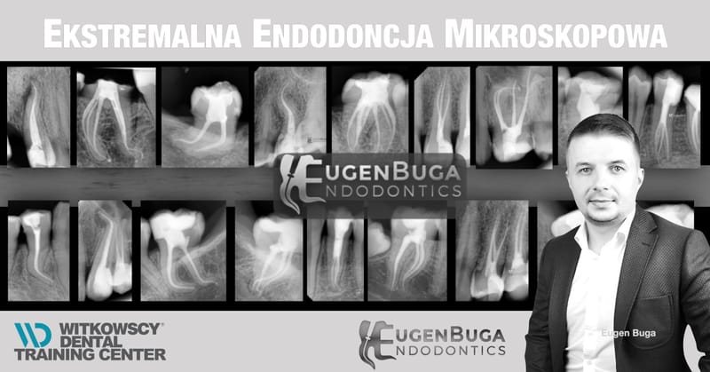 Ekstremalna Endodoncja z Eugenem Bugą