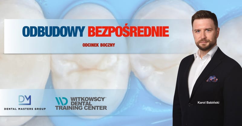 Bezpośrednie odbudowy kompozytowe