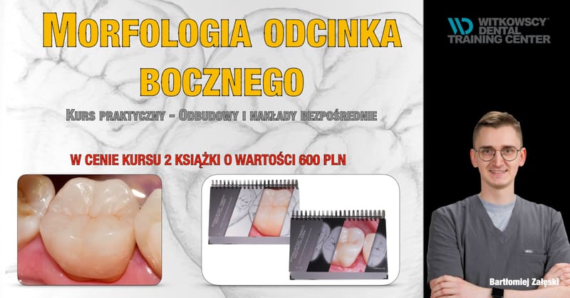 Morfologia odcinka bocznego - Kurs praktyczny - Odbudowy i nakłady bezpośrednie