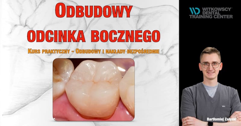 Odbudowy odcinka bocznego - Kurs praktyczny - Odbudowy i nakłady bezpośrednie