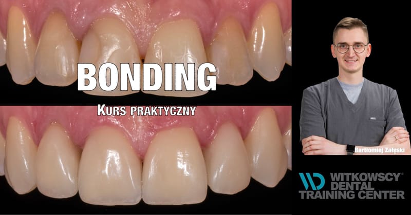 BONDING - Kurs Praktyczny