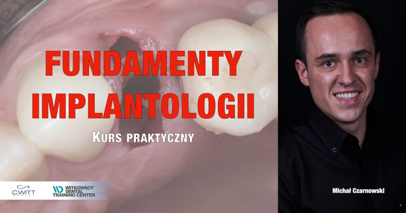 Fundamenty Implantologii - Kurs praktyczny dla młodych dentystów