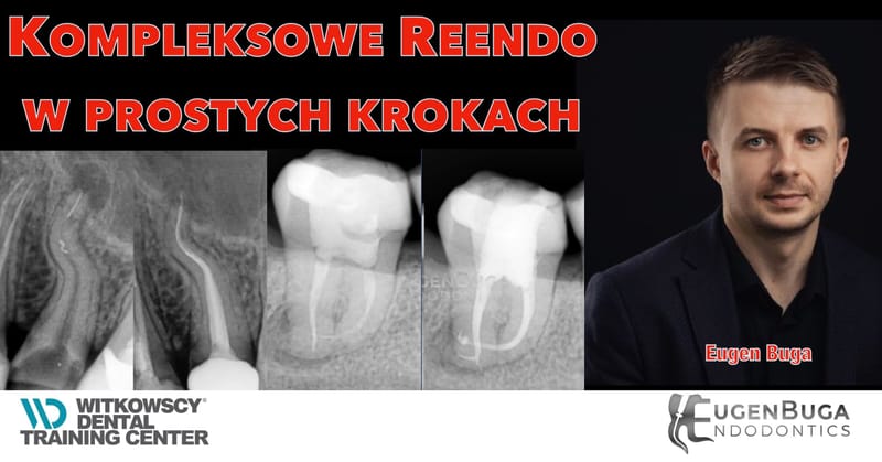 Kompleksowe Reendo w prostych krokach