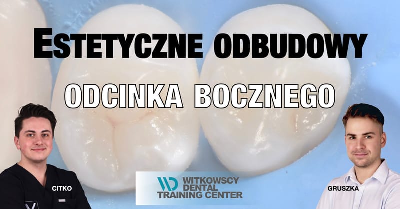 Estetyczne odbudowy odcinka bocznego