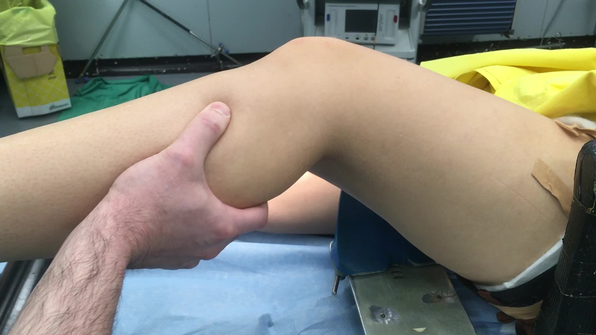 Classificazione delle lesioni del LCA