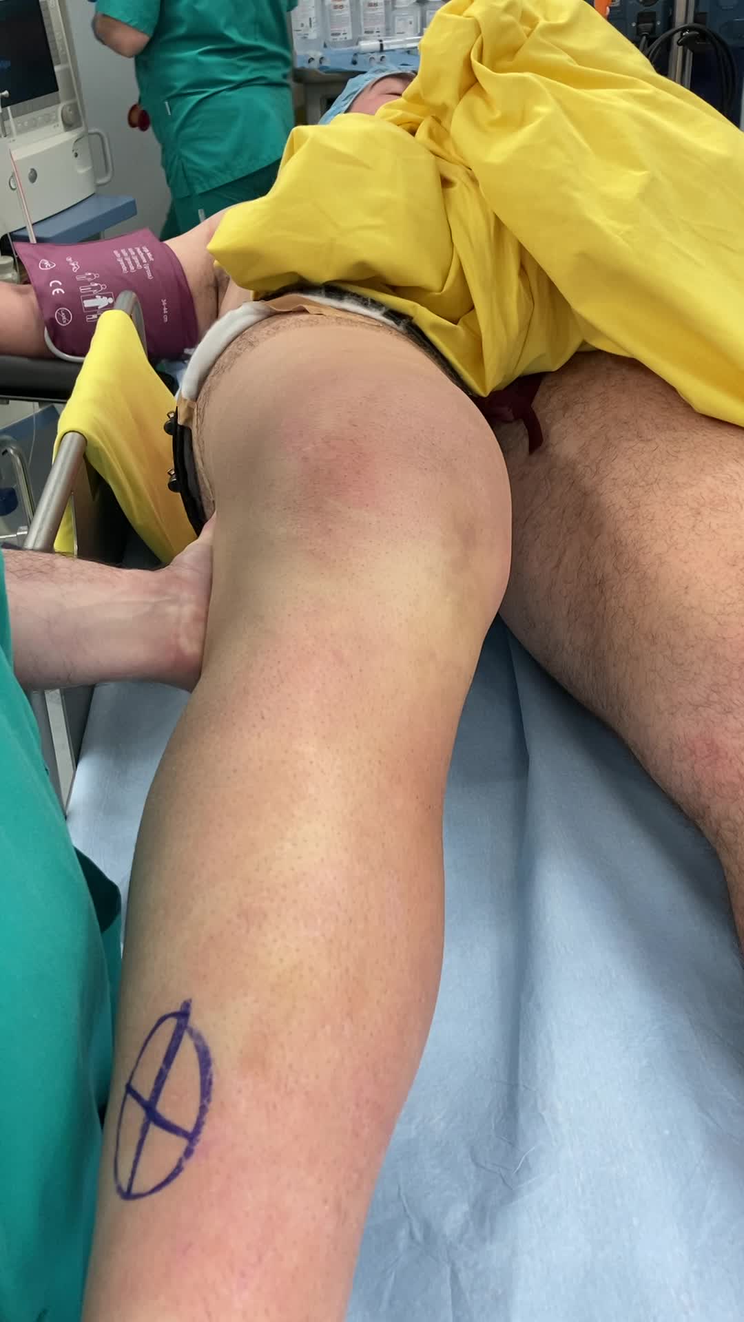 Quali sono i sintomi?