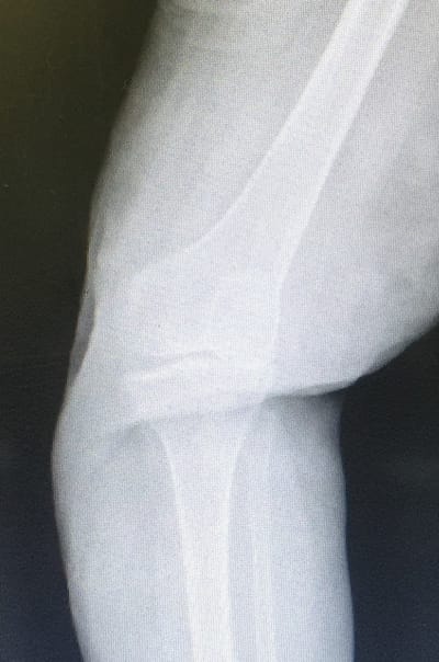 Chirurgia protesica image