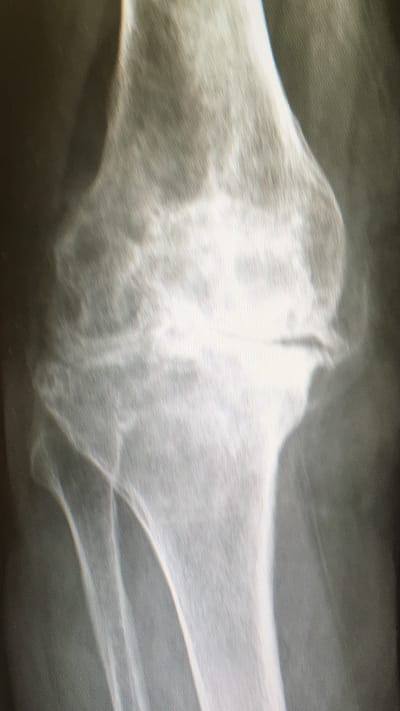 Chirurgia protesica image