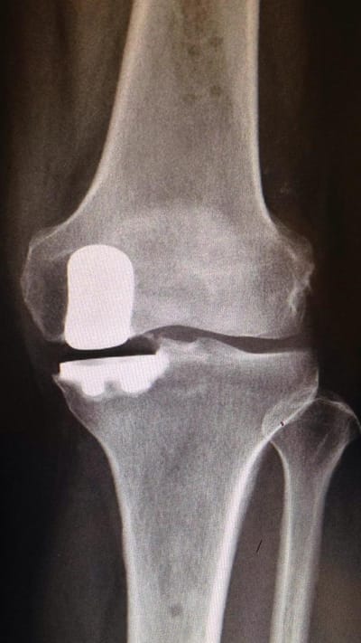 Chirurgia protesica image