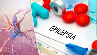 Farmacoterapia de la epilepsia