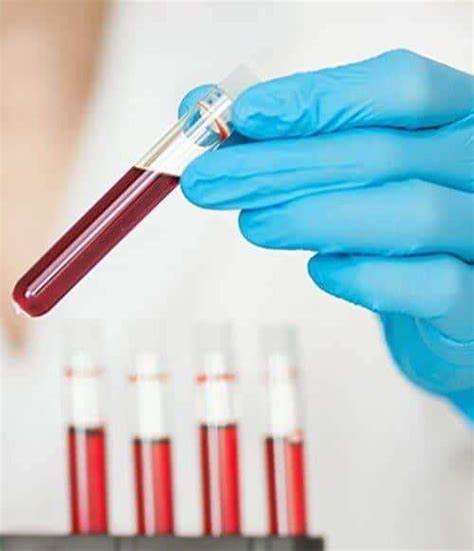 HOME LABORATORY SERVICES