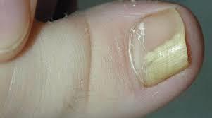 ESPECIALISTAS EN image