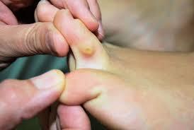 ESPECIALISTAS EN image