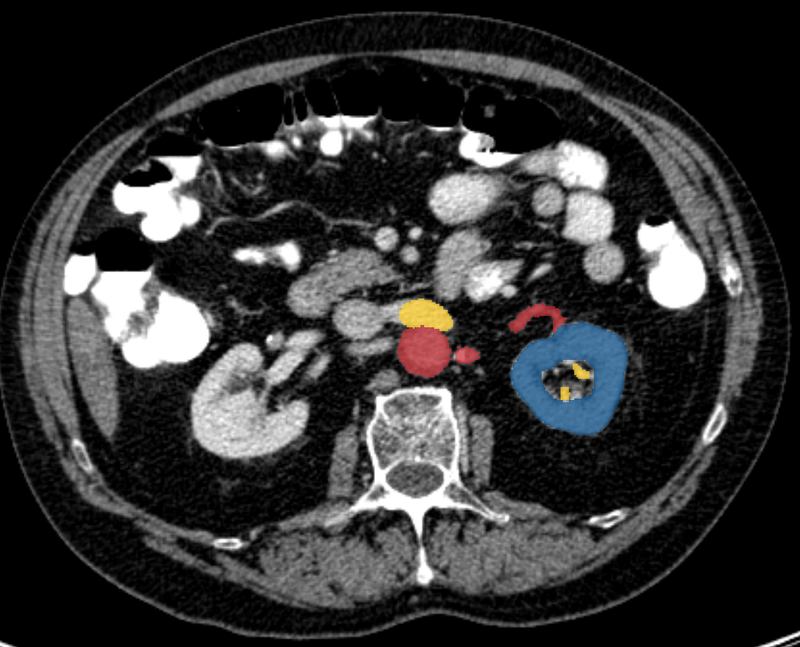 Urinary system