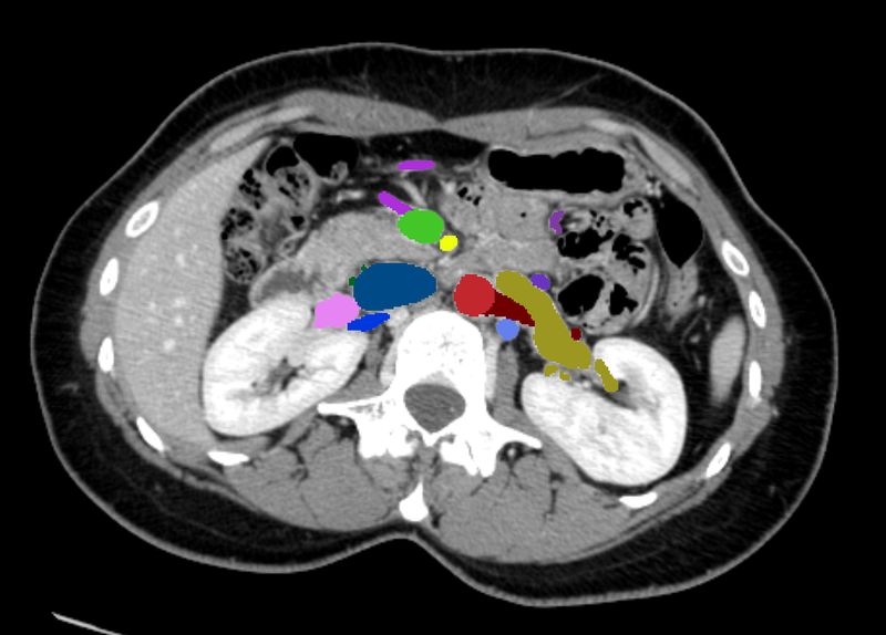 Vasculature of the abdomen