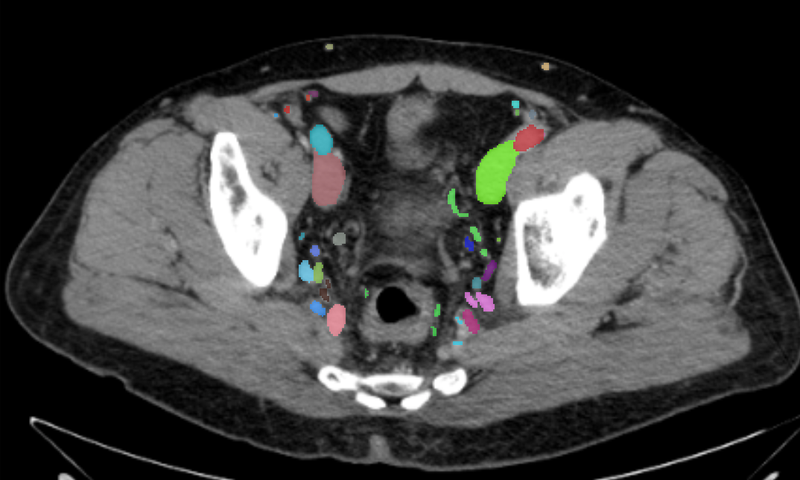 Vasculature of the pelvis