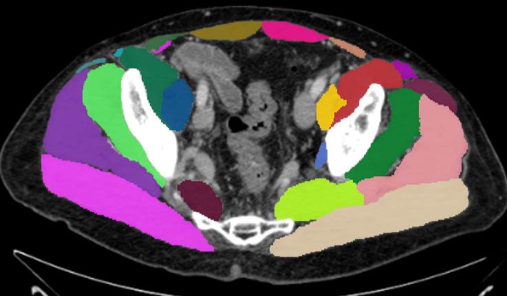 Musculature of the pelvis