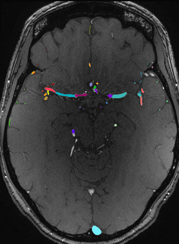 Brain vasculature