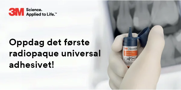 Oppdag det første radiopaque Universal Adhesivet