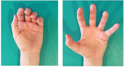 handtherapie image